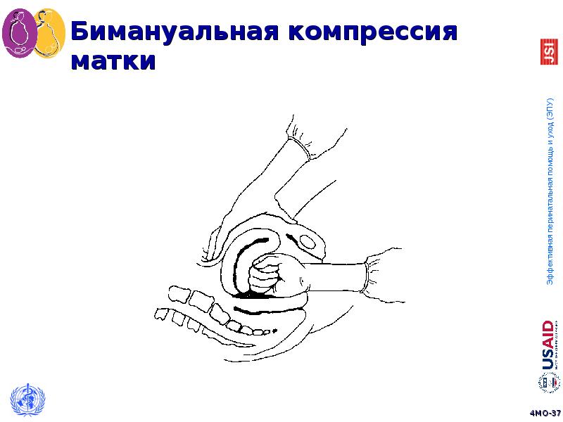 Презентация на тему акушерское кровотечение