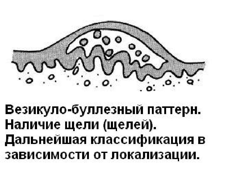 Млечный белок. Везикуло некротическая реакция. Везикуло буллезная форма. Везикуло некротические изменения.