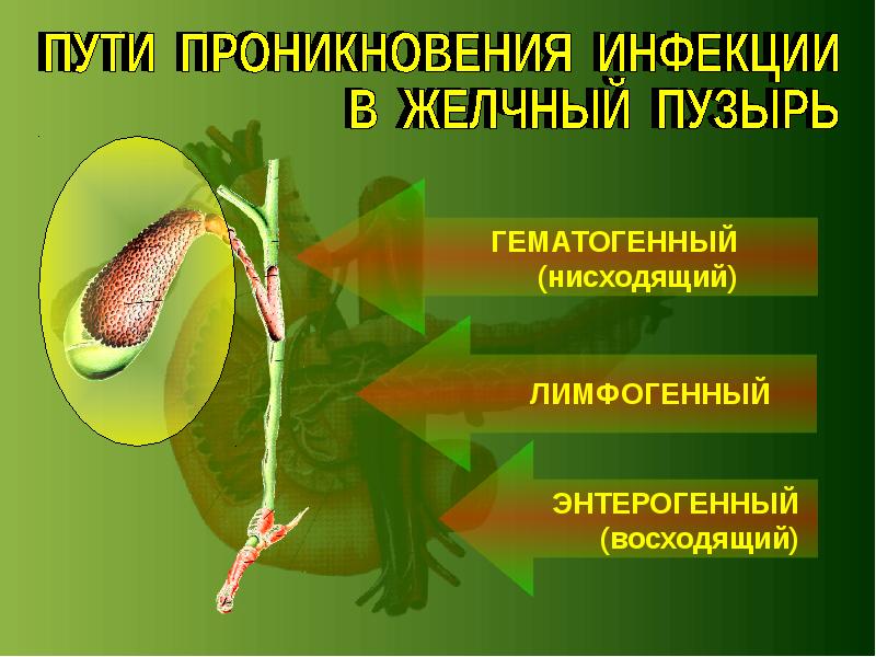 Презентация на тему хронический холецистит