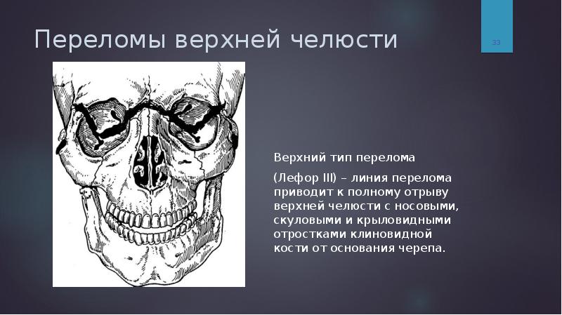 Комбинированные повреждения чло презентация