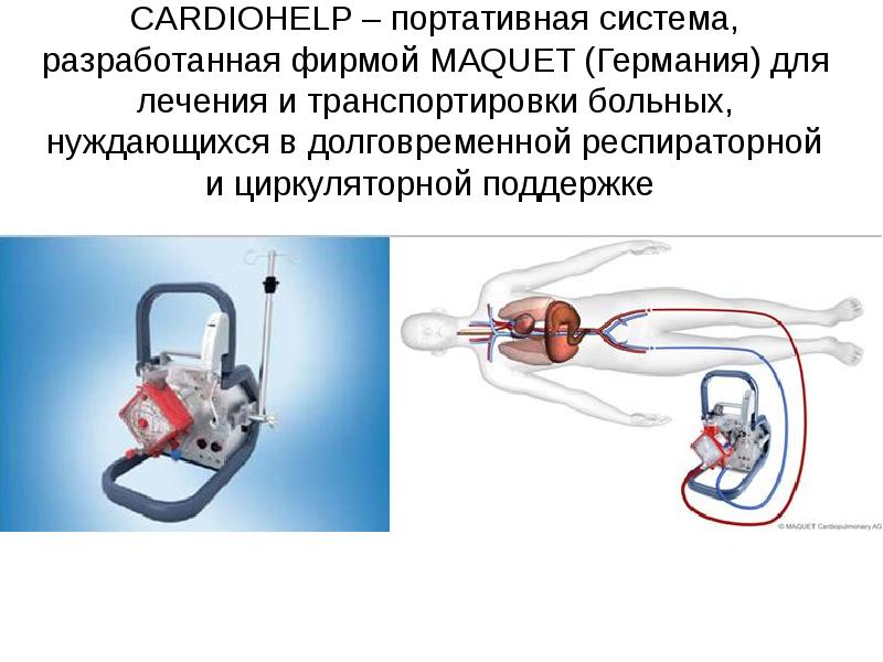 Кардиогенный шок карта смп