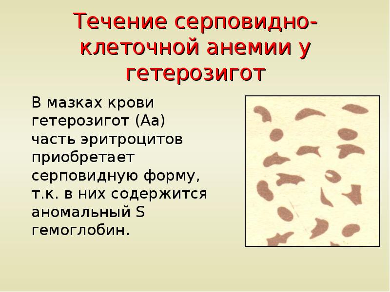 Серповидноклеточная анемия рецессивный. Серповидноклеточная анемия гетерозиготы. Наследование серповидноклеточной анемии. Эритроциты при серповидноклеточной анемии. Тип наследования серповидно-клеточной анемии.