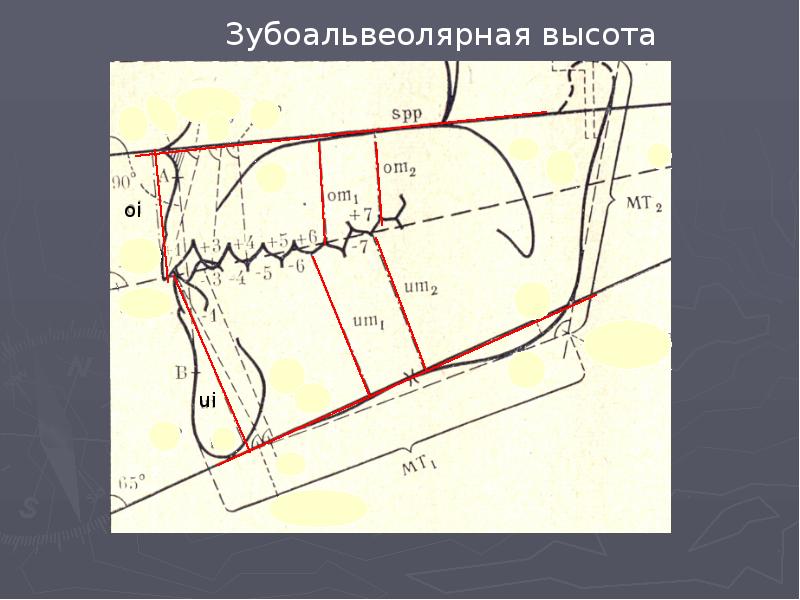 Трг в ортодонтии презентация