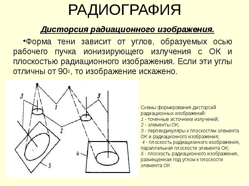 Радиография