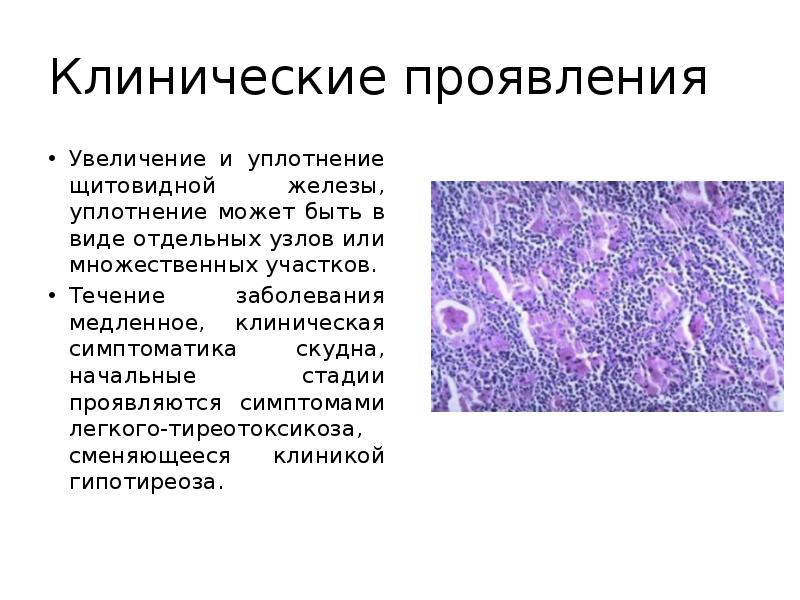 Увеличение проявляться. Аутоиммунные заболевания патанатомия. Аутоиммунные заболевания презентация. Аутоиммунные заболевания начальные стадии. Аутоиммунные заболевания морфология проявления.