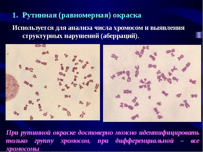 Цитогенетика человека презентация 10 класс