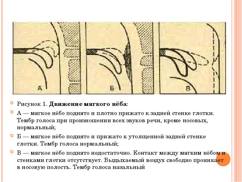 Реферат: Растройства голоса при ринолалии и ринофонии