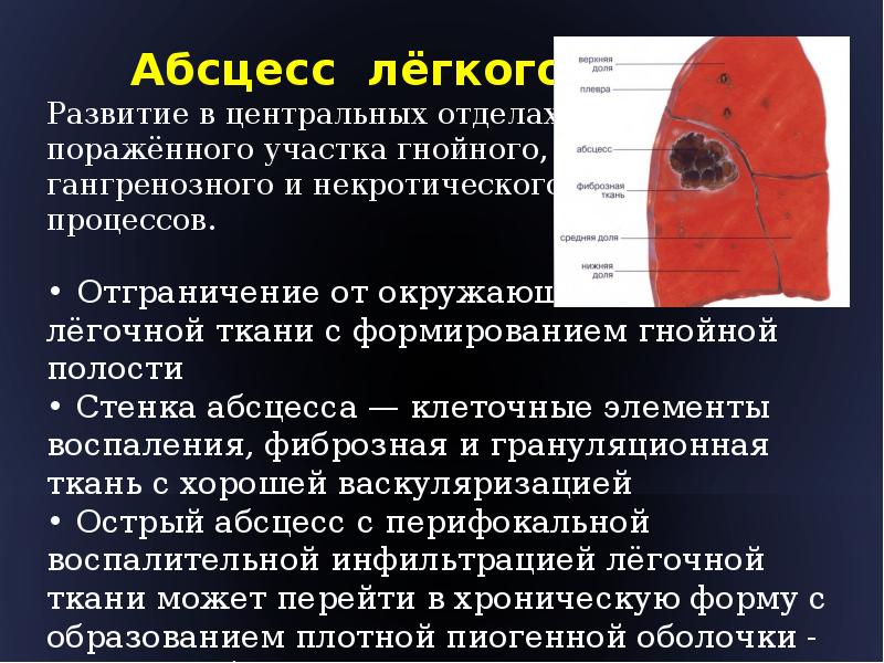 Из чего состоит стенка абсцесса