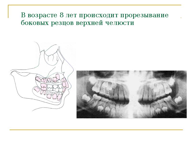 Периоды роста челюстей. Зубной Возраст презентация. Зубочелюстно лицевая система. Основные звенья зубочелюстно-лицевой системы и их функция. Зоны роста челюстных костей.