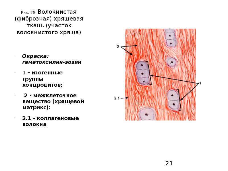 Волокнистый хрящ гистология