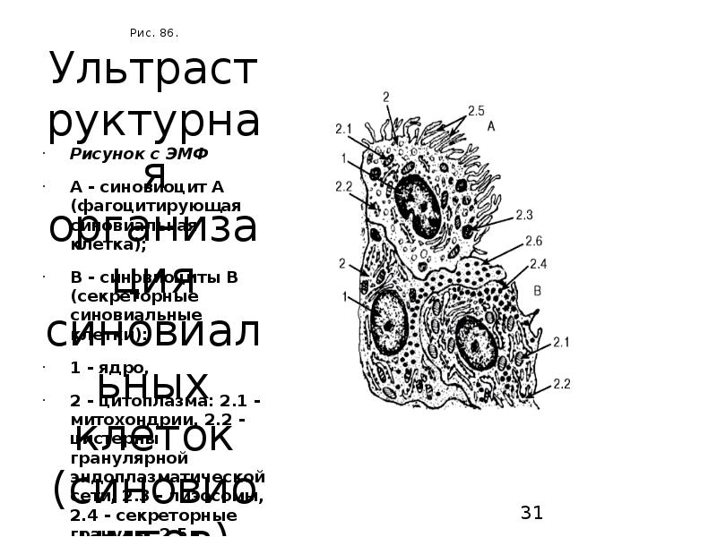 Рис. 86. Ультраструктурная организация синовиальных клеток (синовиоцитов)
Рисунок с ЭМФ
A Рис. 86. Ультраструктурная организация синовиальных клеток (синовиоцитов)
Рисунок с ЭМФ
A