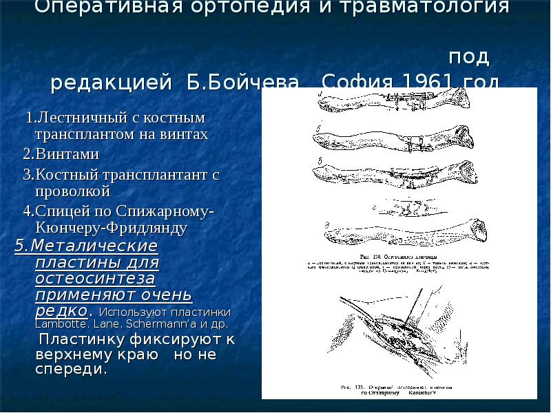 Перелом ключицы презентация