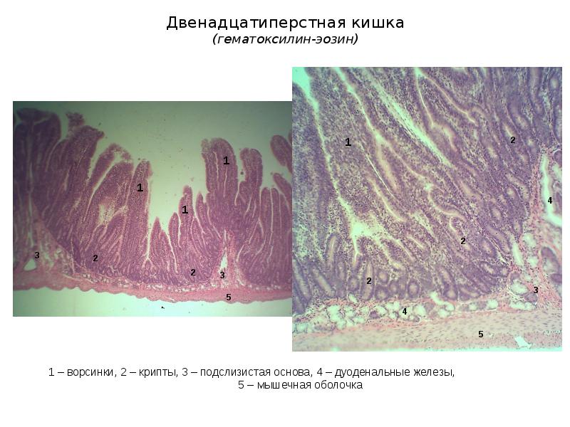 Пищеварительная система презентация гистология