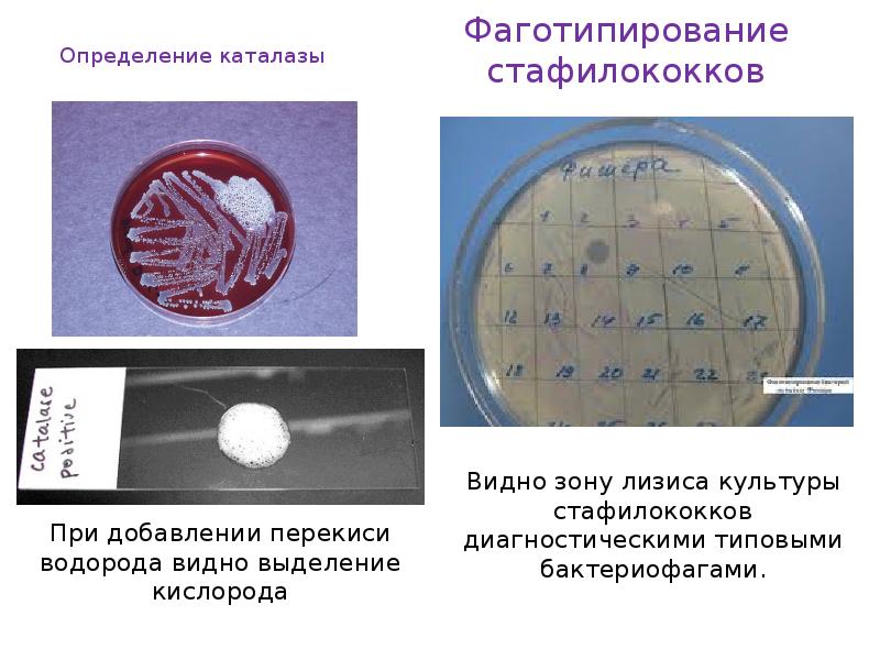 Чувствительность к бактериофагам. Фаготипирование бактерий микробиология. Фаготипирование стафилококковой инфекции. Определение каталазы микробиология. Фаготипирование стафилококков микробиология.