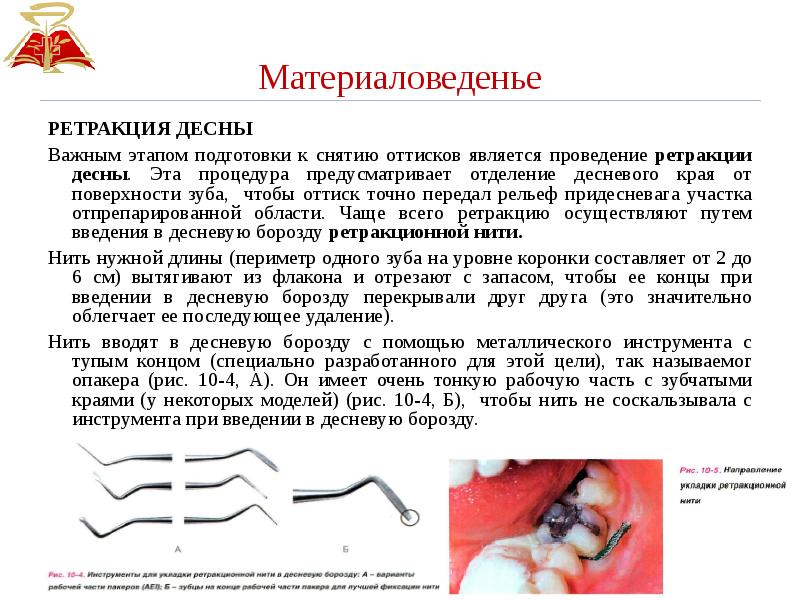 Ретракция