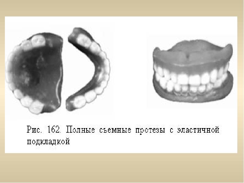 Протезирование у детей презентация