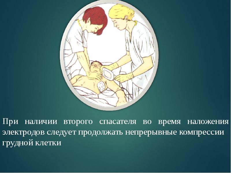 Презентация остановка дыхания