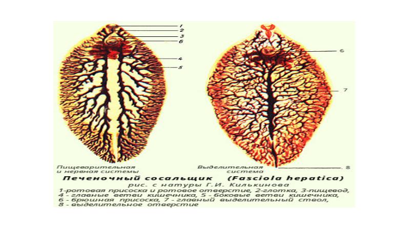 Описторхоз черви фото