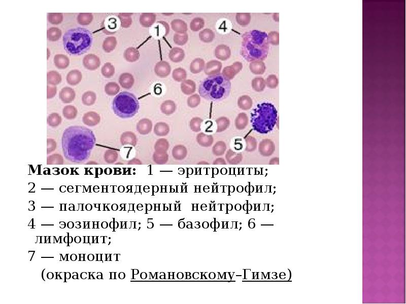 Окраска мазка по романовскому гимза