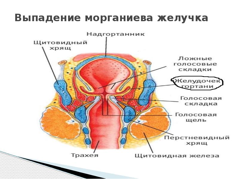 Презентация на тему ларингит