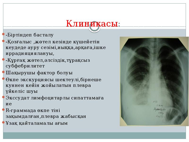 Плеврит клинические рекомендации