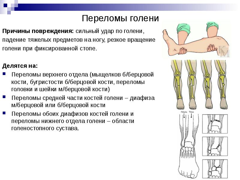 Повреждения кисти травматология презентация