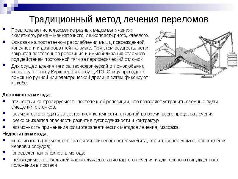 Современные методы лечения переломов презентация