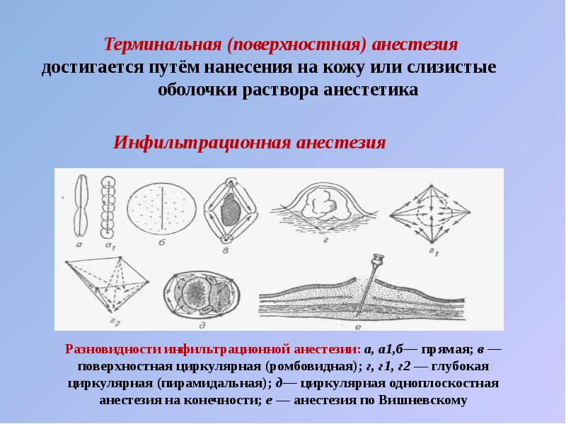 Местное обезболивание презентация