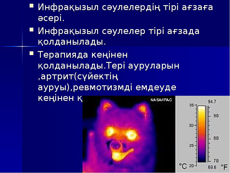 Рентген сәулесі презентация