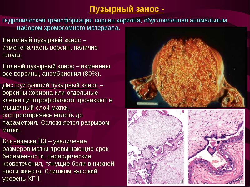 Акушерские кровотечения презентация