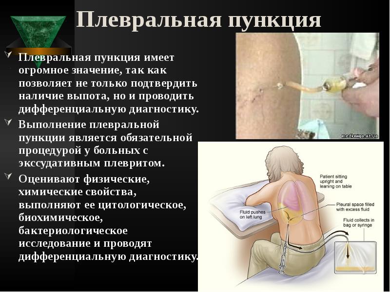 Плевральная пункция
Плевральная пункция имеет огромное значение, так как позволяет не Плевральная пункция
Плевральная пункция имеет огромное значение, так как позволяет не