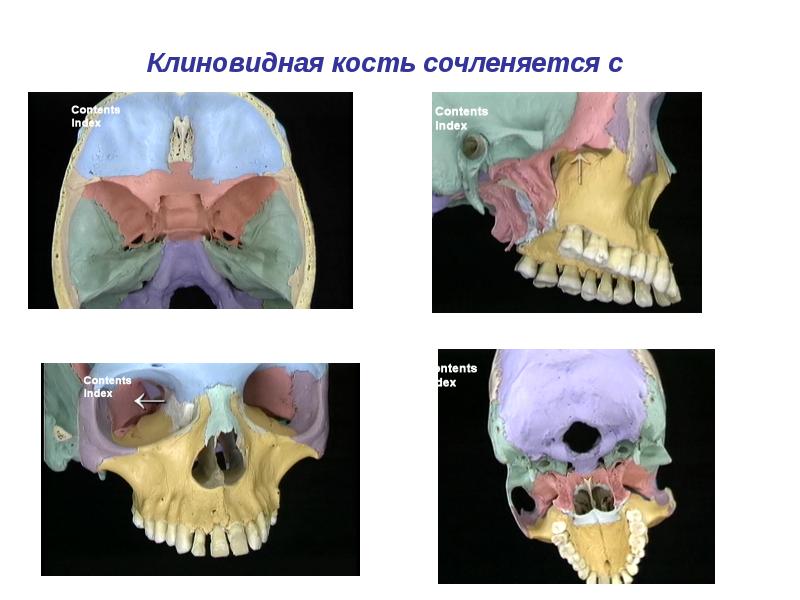 Фото клиновидной кости