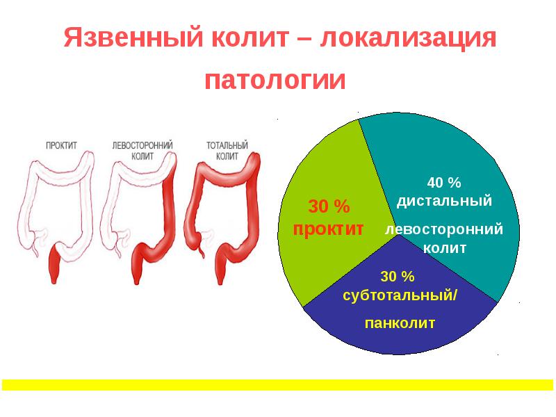 Схема болезни кишечника