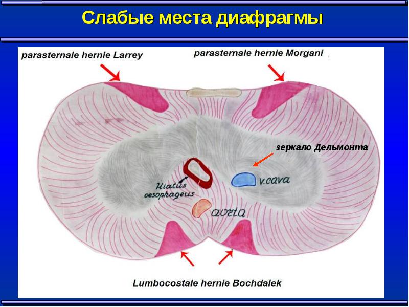 Заболевания диафрагмы госпитальная хирургия презентация