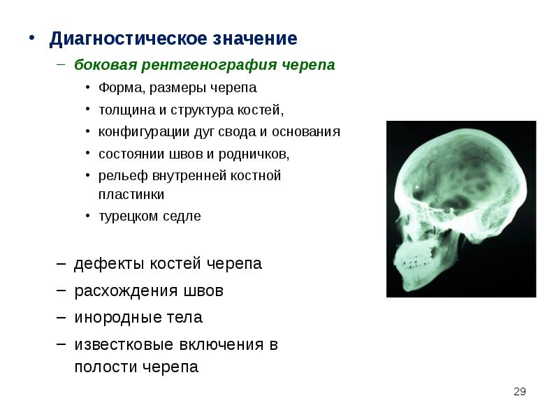 Миастения презентация неврология