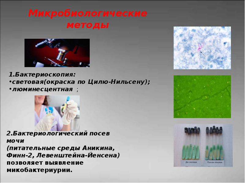 Презентация туберкулез мочевыделительной системы