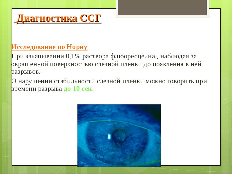 Презентации по синдрому сухого глаза thumbnail