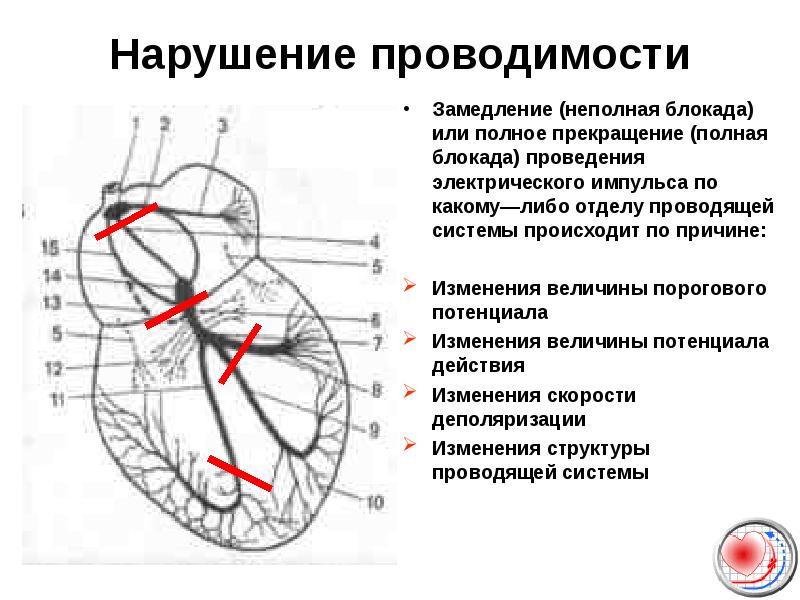 Проводимость сердца схема