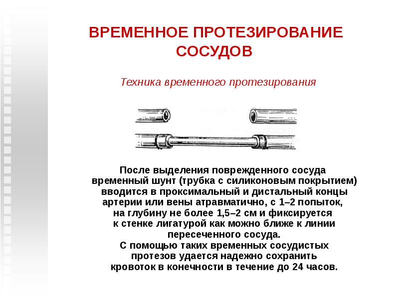 Протезирование сосудов презентация