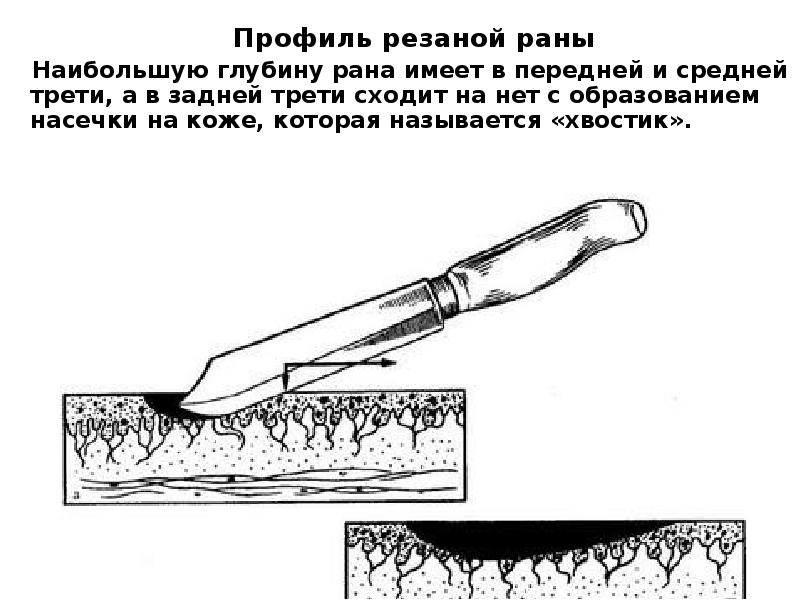 Ран в предметами. Механизм повреждения резаной раны. Колото-резаная рана судебная медицина. Механизм образования колото-резаных РАН. Механизм повреждения колото резаной раны.