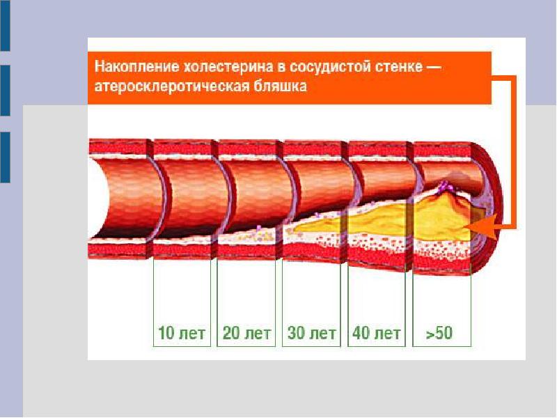 Патология сосудистой стенки