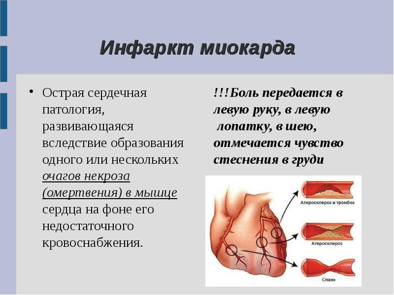 Презентация ссс заболевания