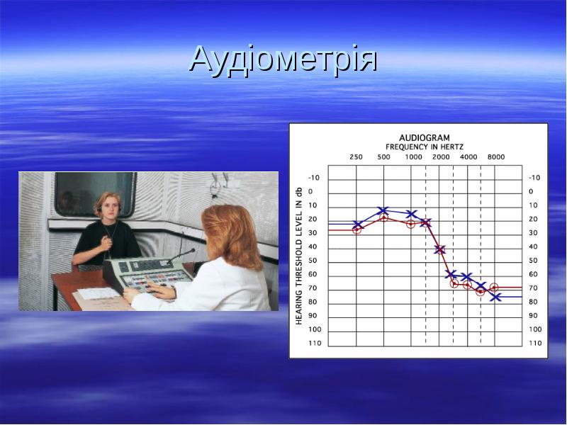 Аудіометрія Аудіометрія