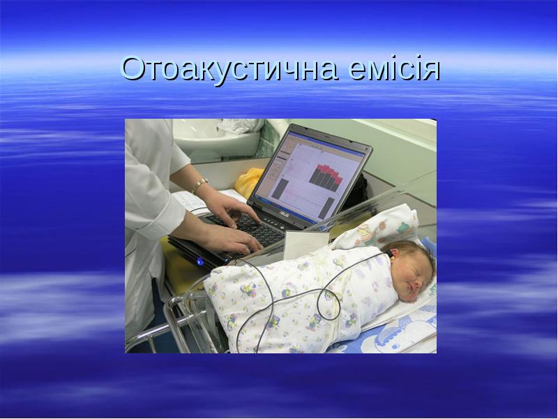 Отоакустична емісія Отоакустична емісія