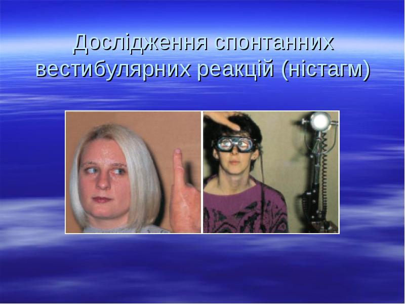 Дослідження спонтанних вестибулярних реакцій (ністагм) Дослідження спонтанних вестибулярних реакцій (ністагм)