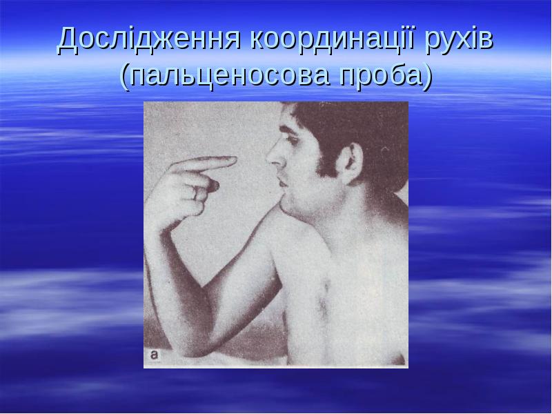 Дослідження координації рухів (пальценосова проба) Дослідження координації рухів (пальценосова проба)