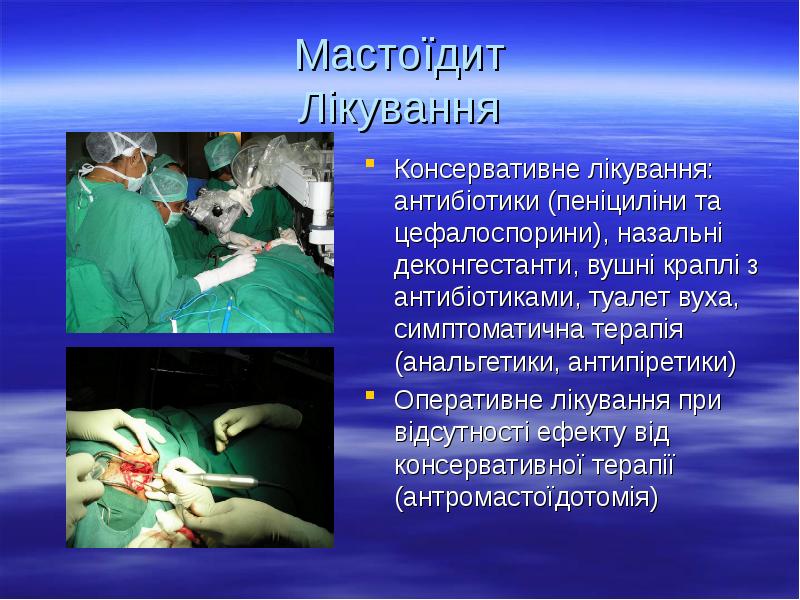 Мастоїдит Лікування
Консервативне лікування: антибіотики (пеніциліни та цефалоспорини), назальні деконгестанти, вушні Мастоїдит Лікування
Консервативне лікування: антибіотики (пеніциліни та цефалоспорини), назальні деконгестанти, вушні