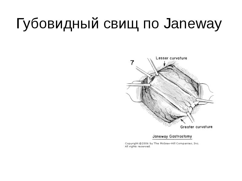 Свищи хирургия презентация