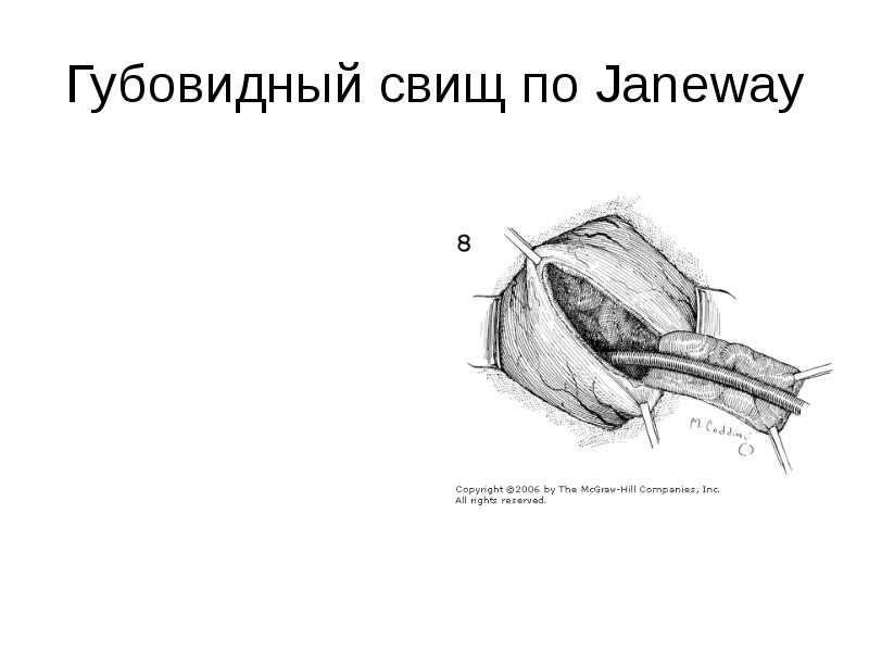 Свищи хирургия презентация