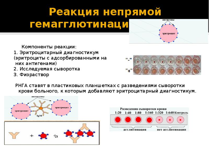 Реакция гемагглютинации. Схема постановки реакции непрямой гемагглютинации. Серологическая реакция гемагглютинации. Реакция прямой гемагглютинации схема. Реакция гемагглютинации положительный результат.